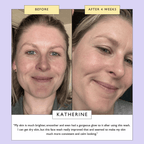 Powder To Foam Face Wash with Willow Bark + Papaya Enzymes