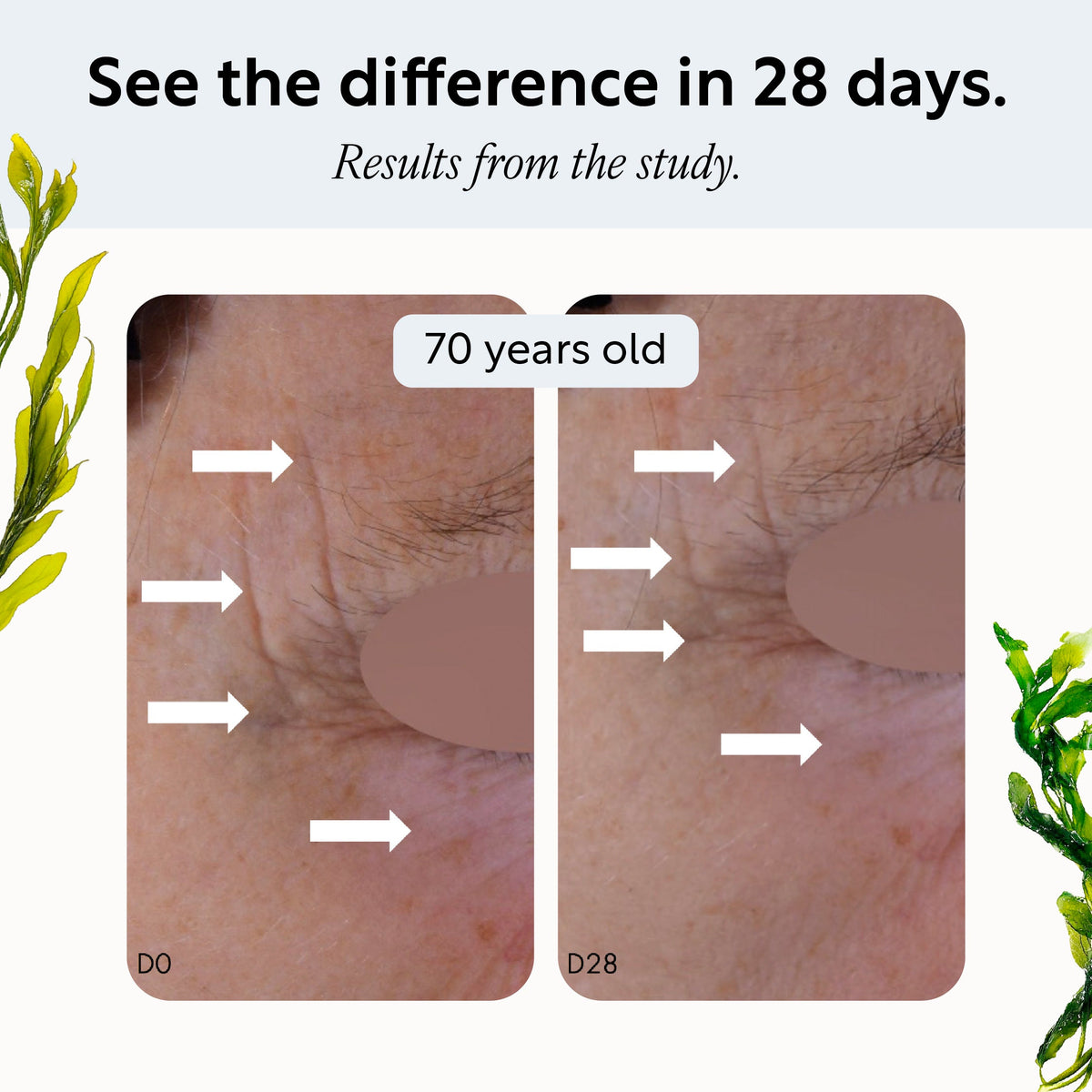 Overnight Eye Treatment with Retinol Exosomes